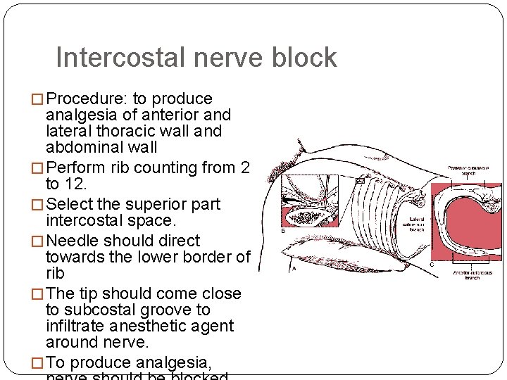Intercostal nerve block � Procedure: to produce analgesia of anterior and lateral thoracic wall