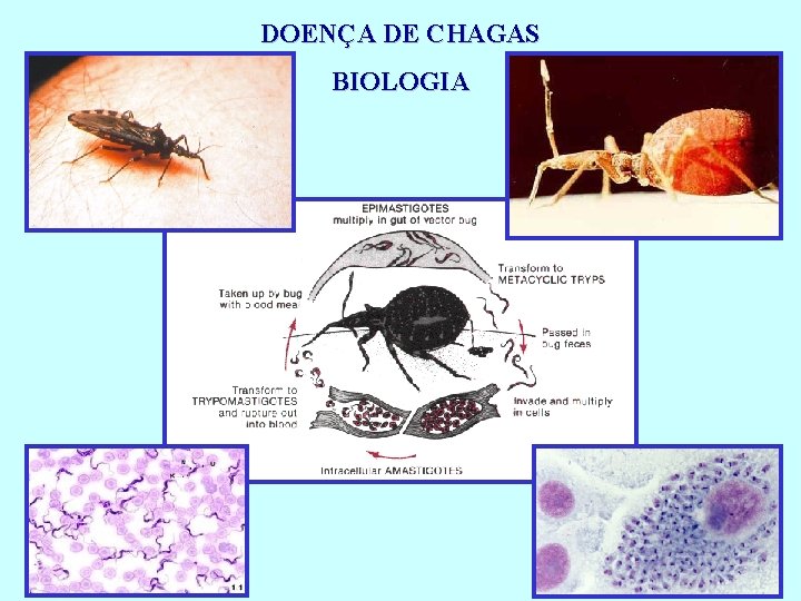 DOENÇA DE CHAGAS BIOLOGIA 