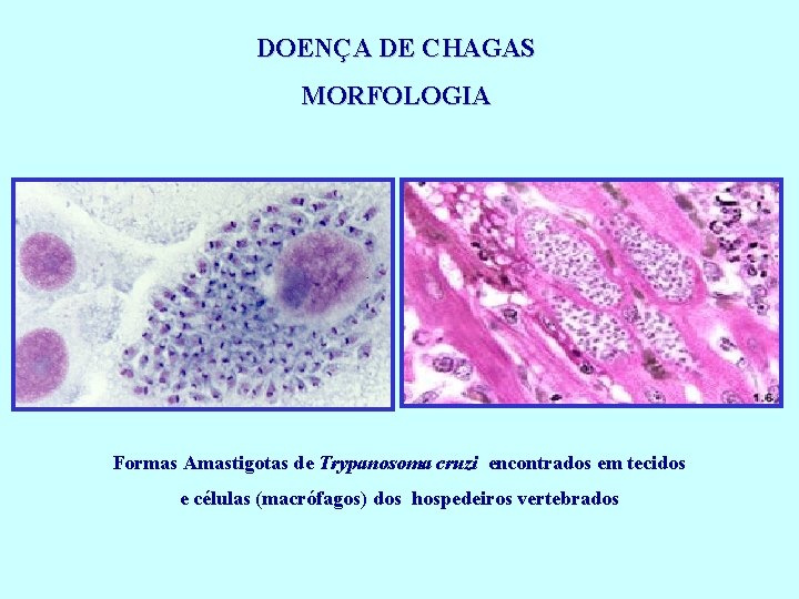 DOENÇA DE CHAGAS MORFOLOGIA Formas Amastigotas de Trypanosoma cruzi encontrados em tecidos e células