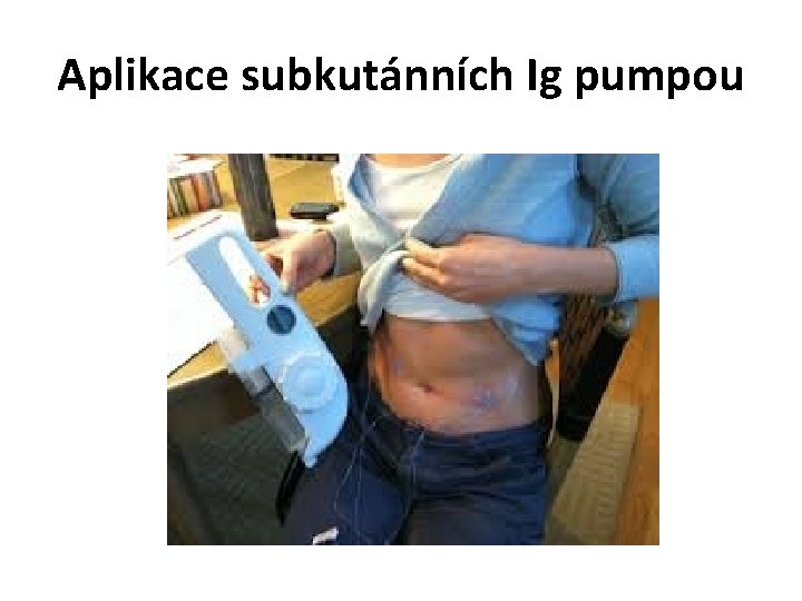 Aplikace subkutánních Ig pumpou 