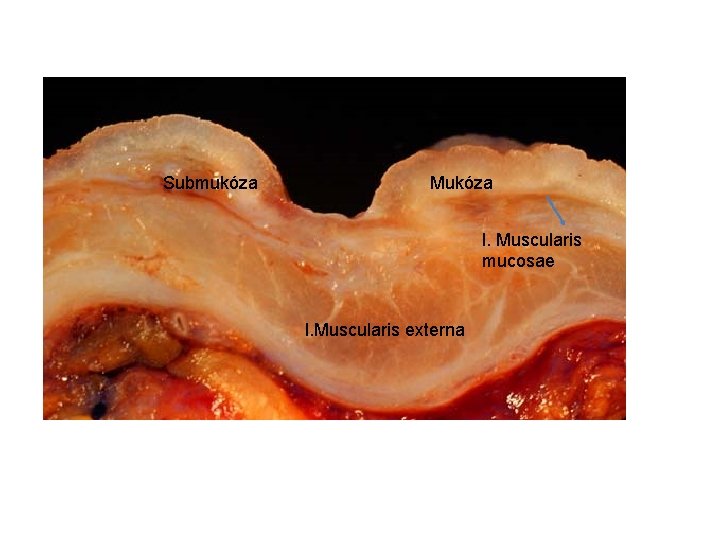 Submukóza Mukóza l. Muscularis mucosae l. Muscularis externa 