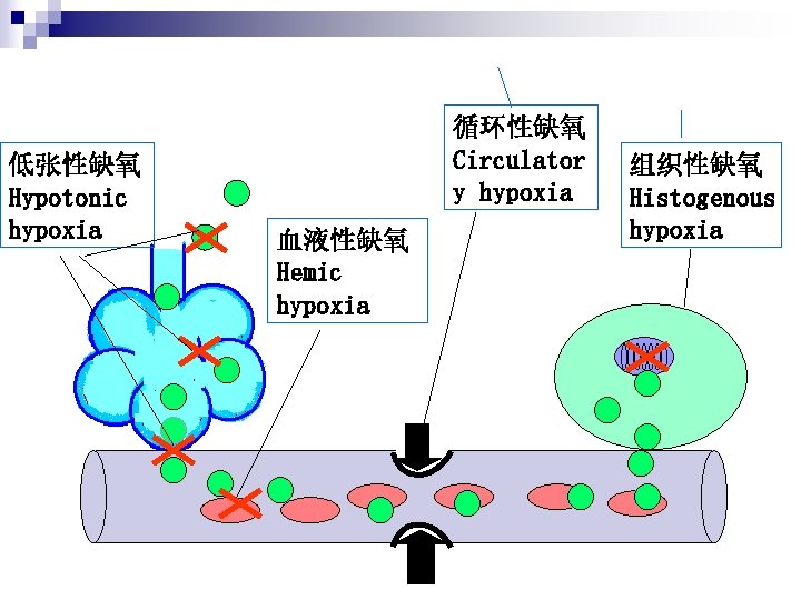 低张性缺氧 Hypotonic hypoxia 循环性缺氧 Circulator y hypoxia 血液性缺氧 Hemic hypoxia 组织性缺氧 Histogenous hypoxia 