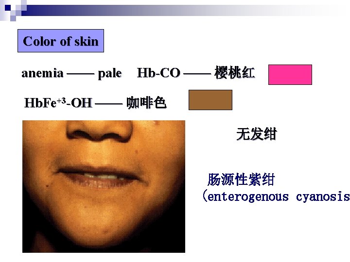 Color of skin anemia —— pale Hb-CO —— 樱桃红 Hb. Fe+3 -OH —— 咖啡色