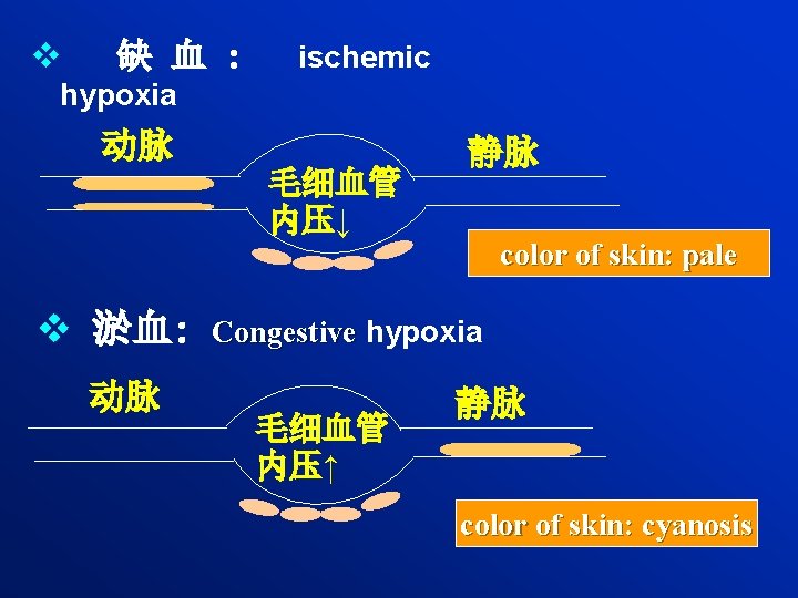 v 缺 血 : ischemic hypoxia 动脉 毛细血管 内压↓ 静脉 color of skin: pale