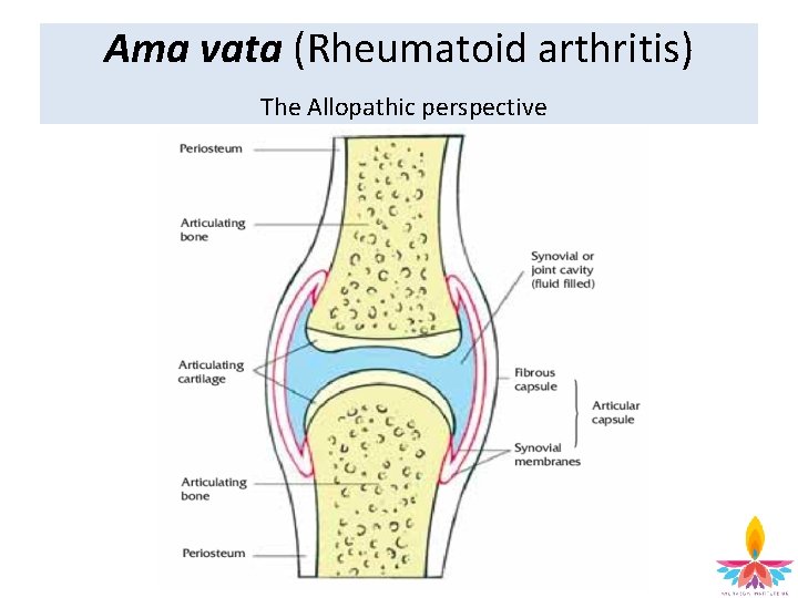 Ama vata (Rheumatoid arthritis) The Allopathic perspective 