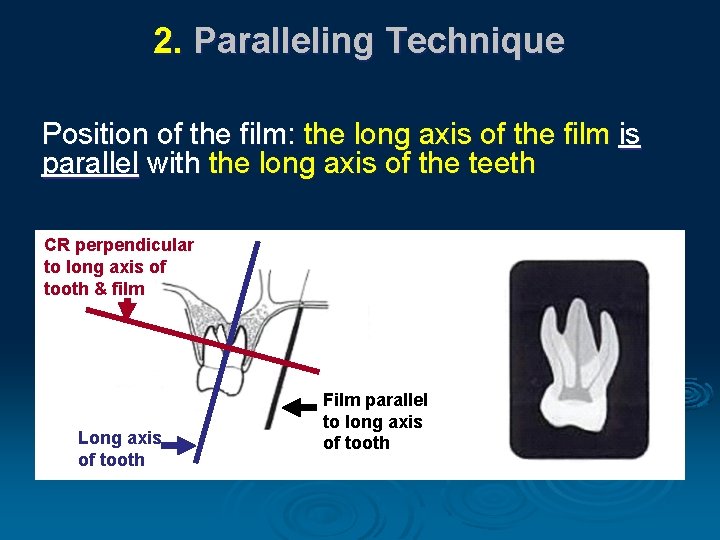 2. Paralleling Technique Position of the film: the long axis of the film is