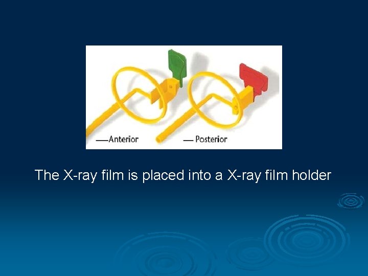 The X-ray film is placed into a X-ray film holder 