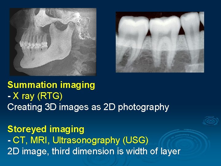 Summation imaging - X ray (RTG) Creating 3 D images as 2 D photography