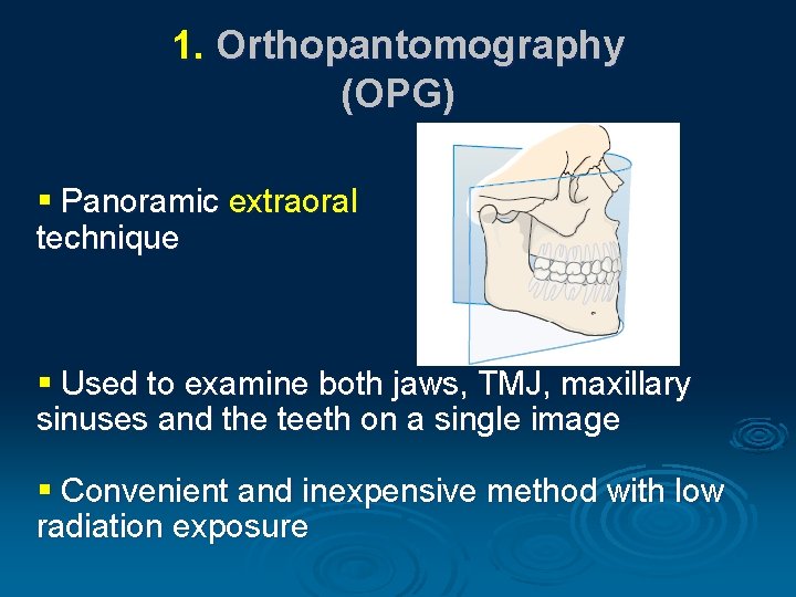1. Orthopantomography (OPG) § Panoramic extraoral technique § Used to examine both jaws, TMJ,