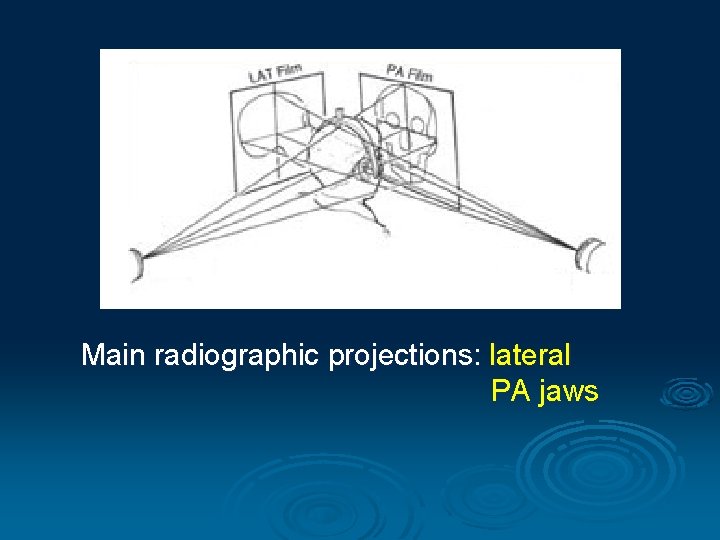 Main radiographic projections: lateral PA jaws 