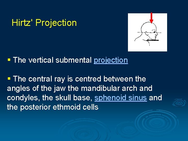 Hirtz' Projection § The vertical submental projection § The central ray is centred between