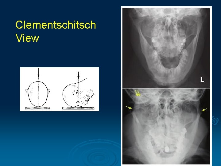 Clementschitsch View Clementschitsch View