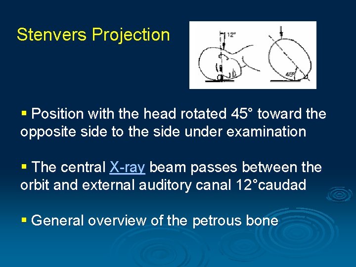 Stenvers Projection § Position with the head rotated 45° toward the opposite side to