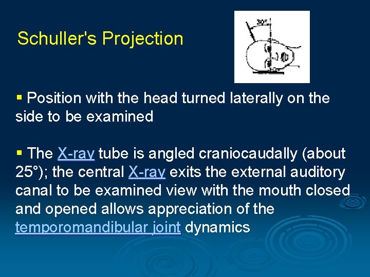 Schuller's Projection § Position with the head turned laterally on the side to be