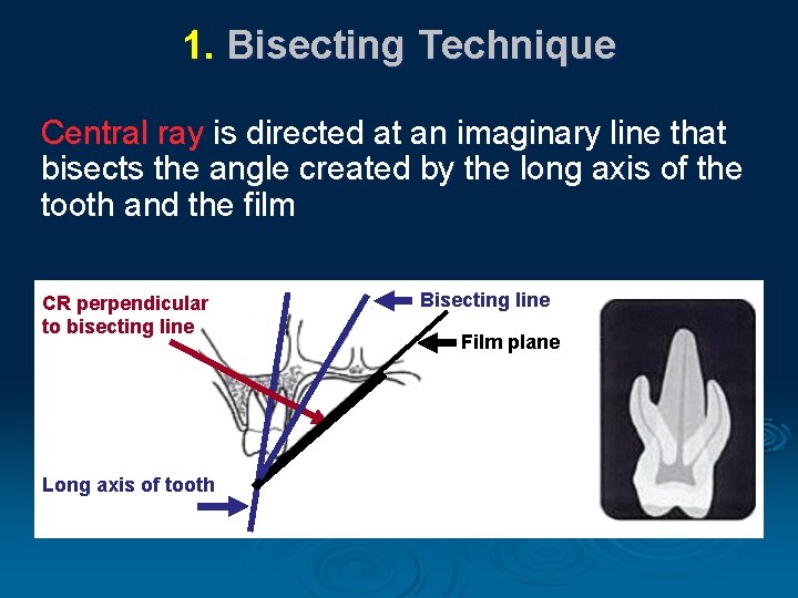 1. Bisecting Technique Central ray is directed at an imaginary line that bisects the