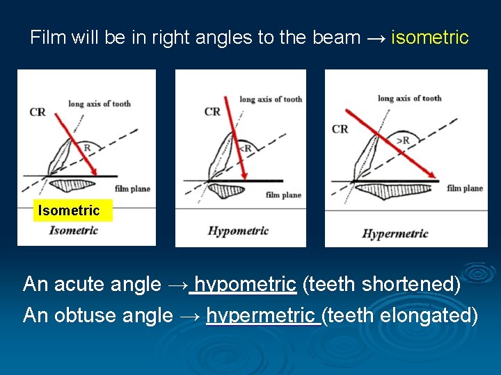 Film will be in right angles to the beam → isometric Isometric An acute