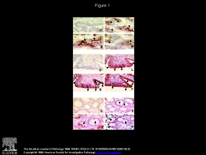 Figure 1 The American Journal of Pathology 1999 155461 -472 DOI: (10. 1016/S 0002