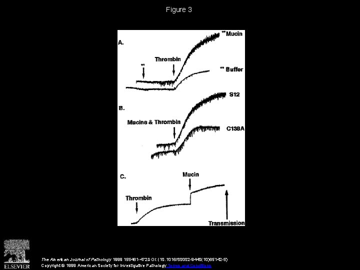 Figure 3 The American Journal of Pathology 1999 155461 -472 DOI: (10. 1016/S 0002