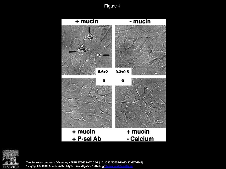Figure 4 The American Journal of Pathology 1999 155461 -472 DOI: (10. 1016/S 0002