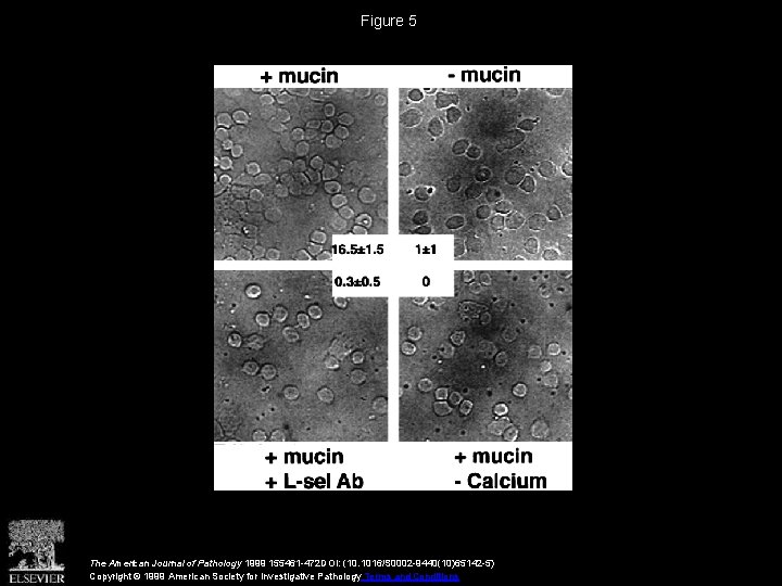 Figure 5 The American Journal of Pathology 1999 155461 -472 DOI: (10. 1016/S 0002