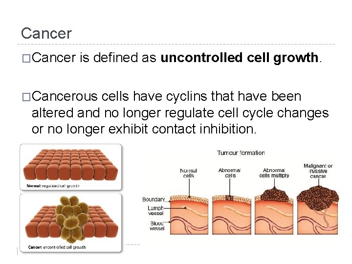 Cancer �Cancer is defined as uncontrolled cell growth. �Cancerous cells have cyclins that have