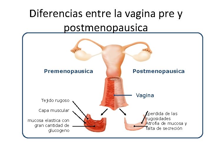 Diferencias entre la vagina pre y postmenopausica Premenopausica Tejido rugoso Capa muscular mucosa elastica