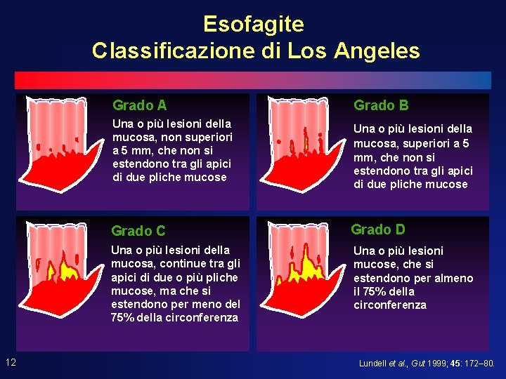 Esofagite Classificazione di Los Angeles 12 Grado A Grado B Una o più lesioni