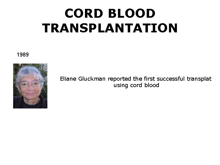 CORD BLOOD TRANSPLANTATION 1989 Eliane Gluckman reported the first successful transplat using cord blood