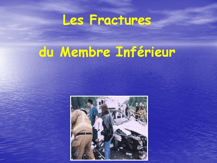 Les Fractures du Membre Inférieur 