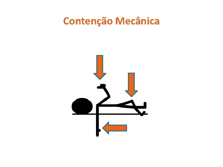 Contenção Mecânica 