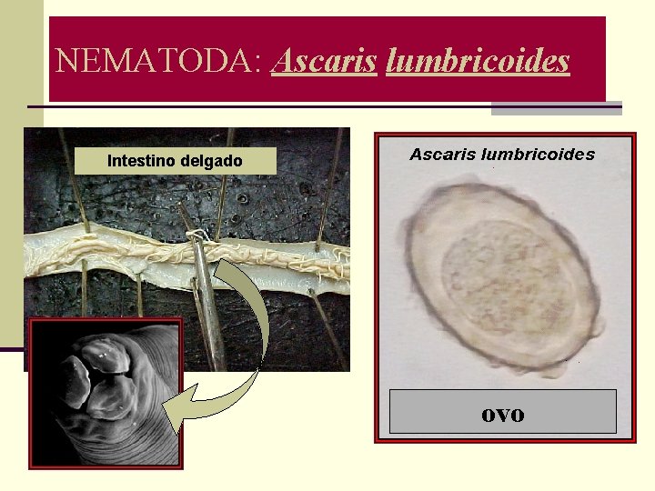 NEMATODA: Ascaris lumbricoides Intestino delgado ovo 
