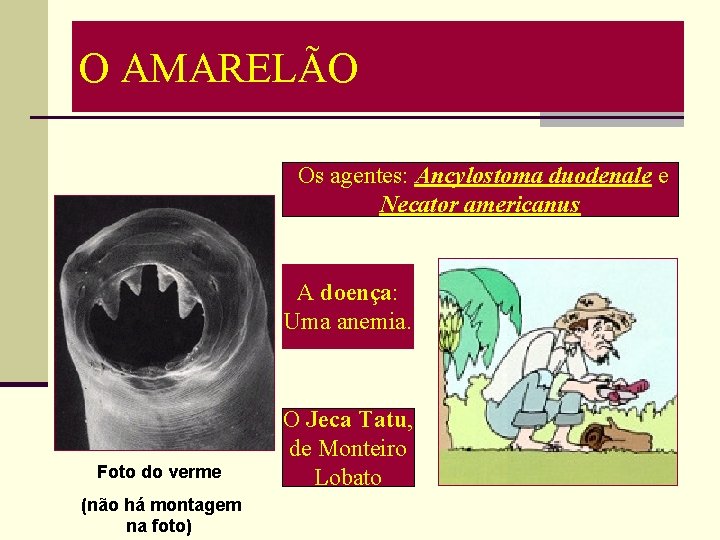 O AMARELÃO Os agentes: Ancylostoma duodenale e Necator americanus A doença: Uma anemia. Foto