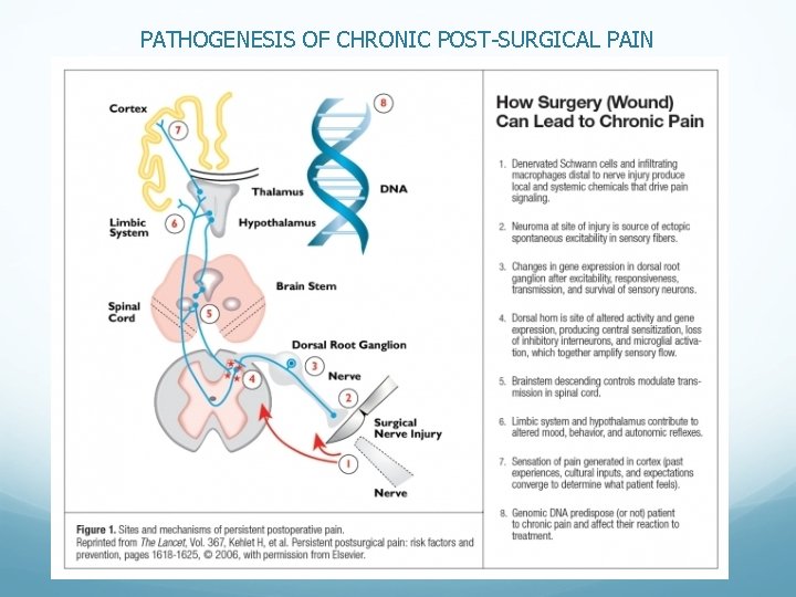 PATHOGENESIS OF CHRONIC POST-SURGICAL PAIN PATHOGENESIS OF CHRONIC POST-SURGICAL PAIN