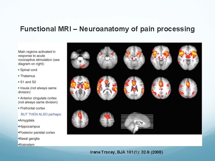 Functional MRI – Neuroanatomy of pain processing Irene Tracey, BJA 101(1): 32 -9 (2008) Functional MRI – Neuroanatomy of pain processing Irene Tracey, BJA 101(1): 32 -9 (2008)