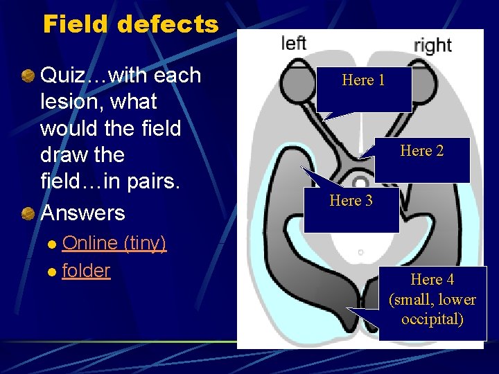 Field defects Quiz…with each lesion, what would the field draw the field…in pairs. Answers