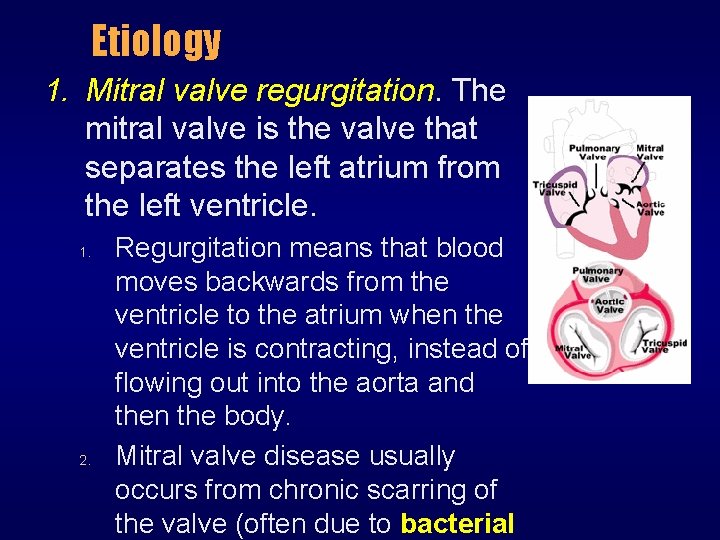 Etiology 1. Mitral valve regurgitation. The mitral valve is the valve that separates the
