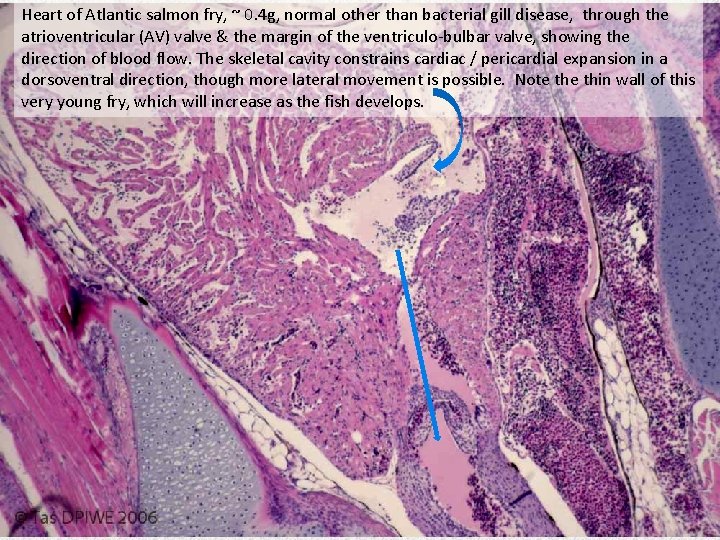 Heart of Atlantic salmon fry, ~ 0. 4 g, normal other than bacterial gill