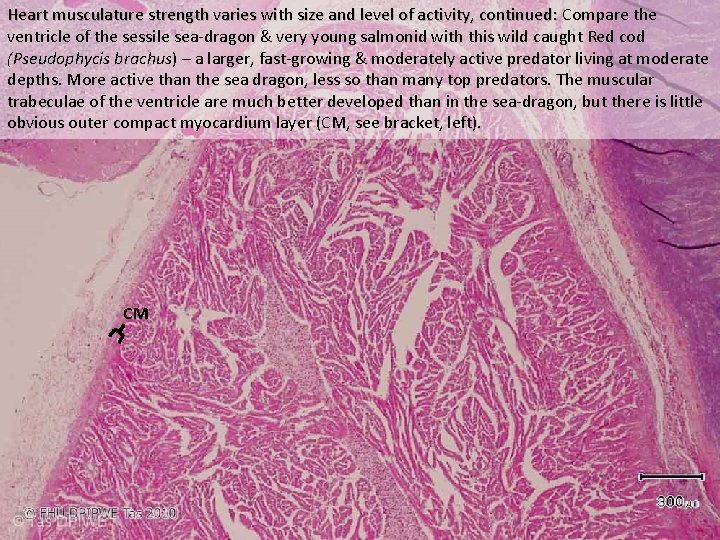 Heart musculature strength varies with size and level of activity, continued: Compare the ventricle