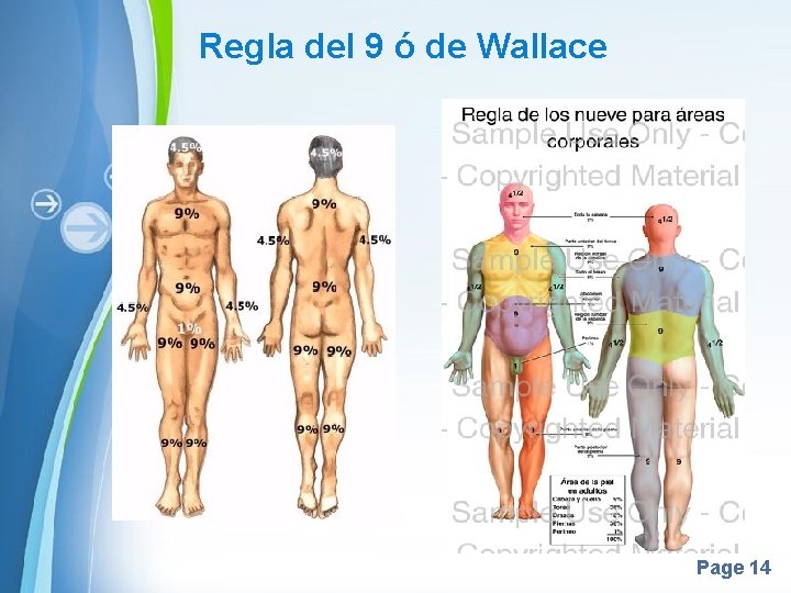 Regla del 9 ó de Wallace Page 14 Regla del 9 ó de Wallace Page 14