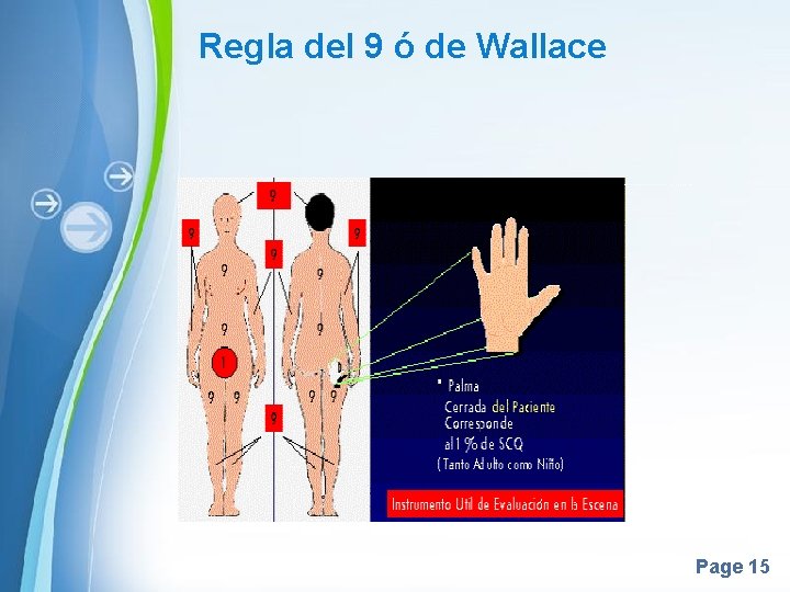 Regla del 9 ó de Wallace Page 15 Regla del 9 ó de Wallace Page 15
