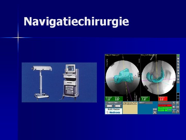 Navigatiechirurgie 