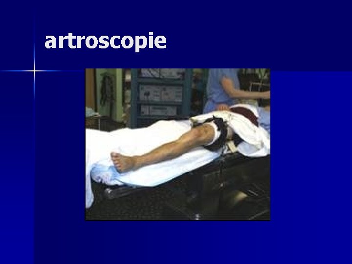 artroscopie 