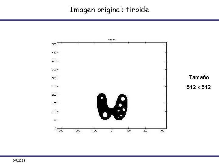 Imagen original: tiroide Tamaño 512 x 512 6/7/2021 