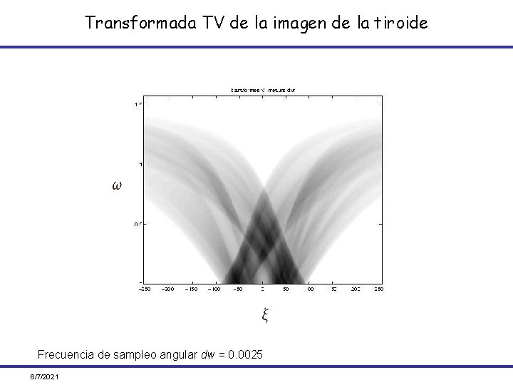 Transformada TV de la imagen de la tiroide Frecuencia de sampleo angular dw =