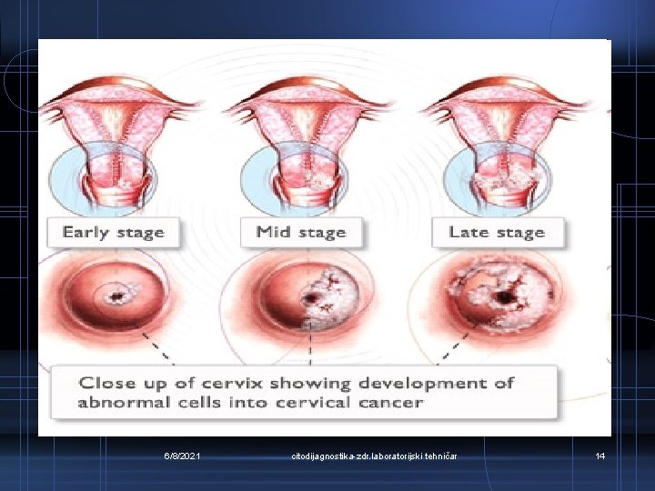 6/8/2021 citodijagnostika-zdr. laboratorijski tehničar 14 
