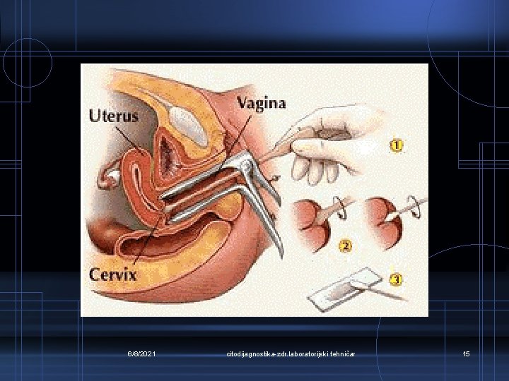 6/8/2021 citodijagnostika-zdr. laboratorijski tehničar 15 