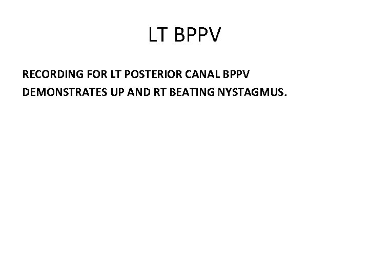 LT BPPV RECORDING FOR LT POSTERIOR CANAL BPPV DEMONSTRATES UP AND RT BEATING NYSTAGMUS.