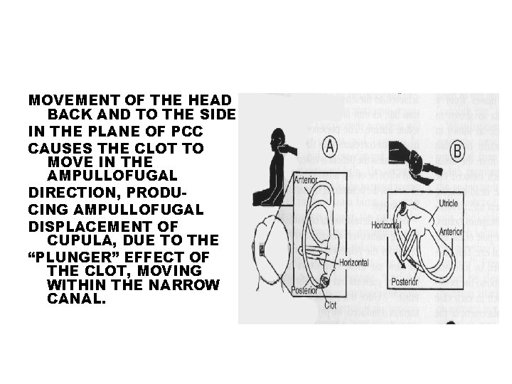 MOVEMENT OF THE HEAD BACK AND TO THE SIDE IN THE PLANE OF PCC