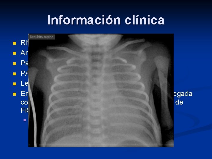 Información clínica n n n RNPT de 29 + 1 semanas. Antecedente materno: Preeclampsia.