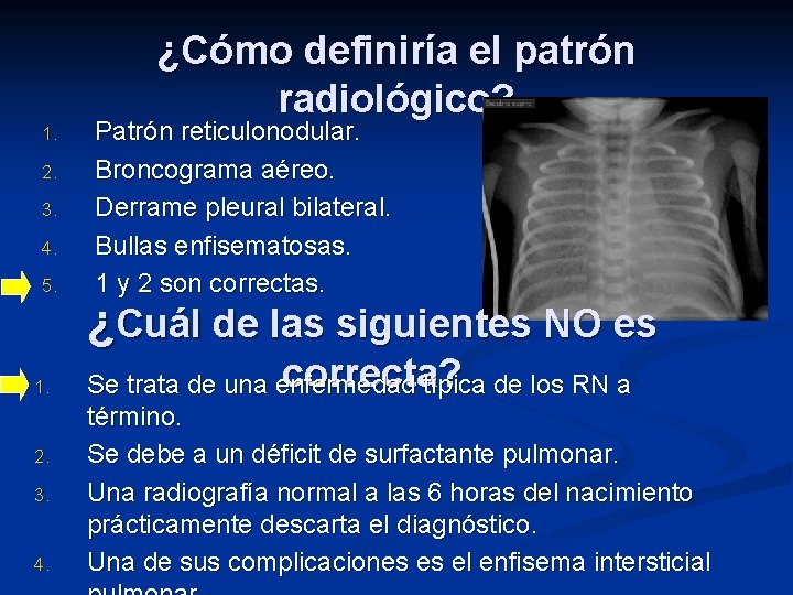 ¿Cómo definiría el patrón radiológico? 1. 2. 3. 4. 5. 1. 2. 3. 4.